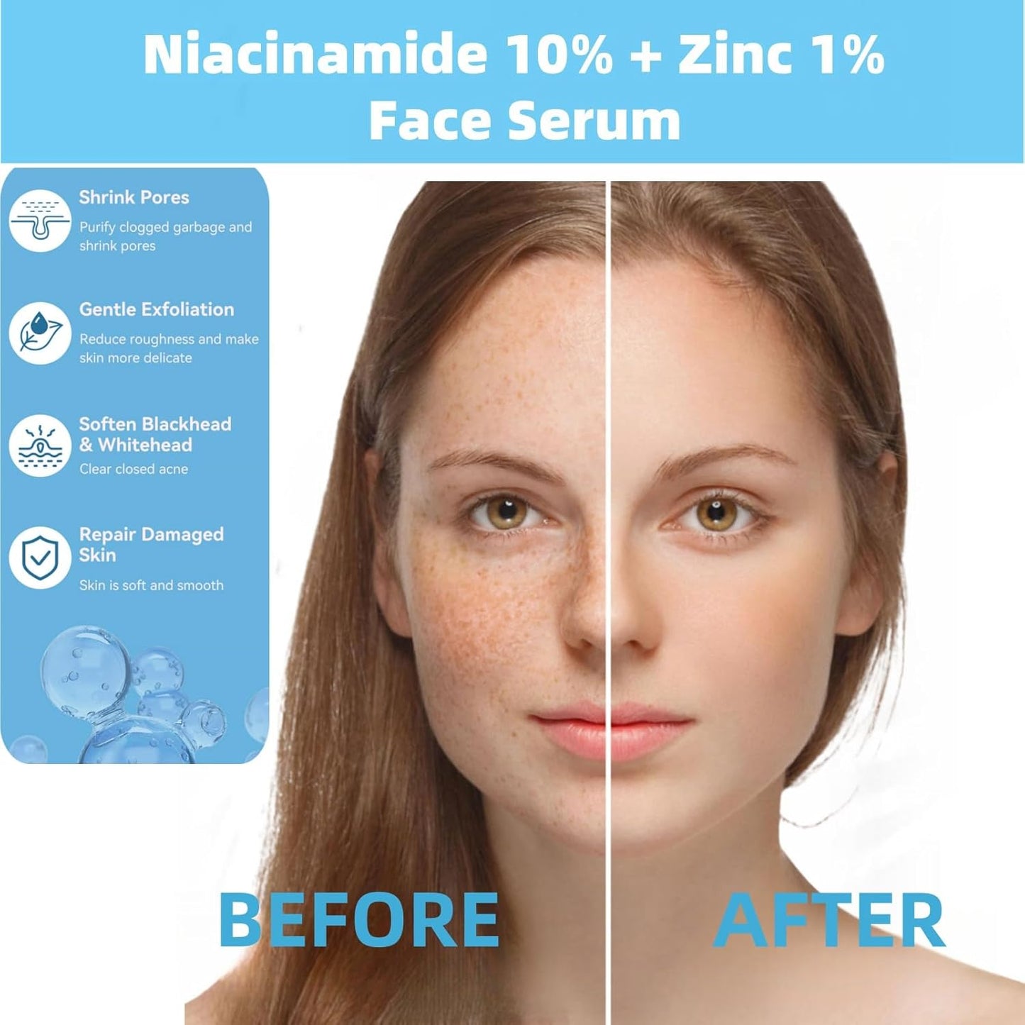 The Ordinary Niacinamide 10% + Zinc 1% (30ml)