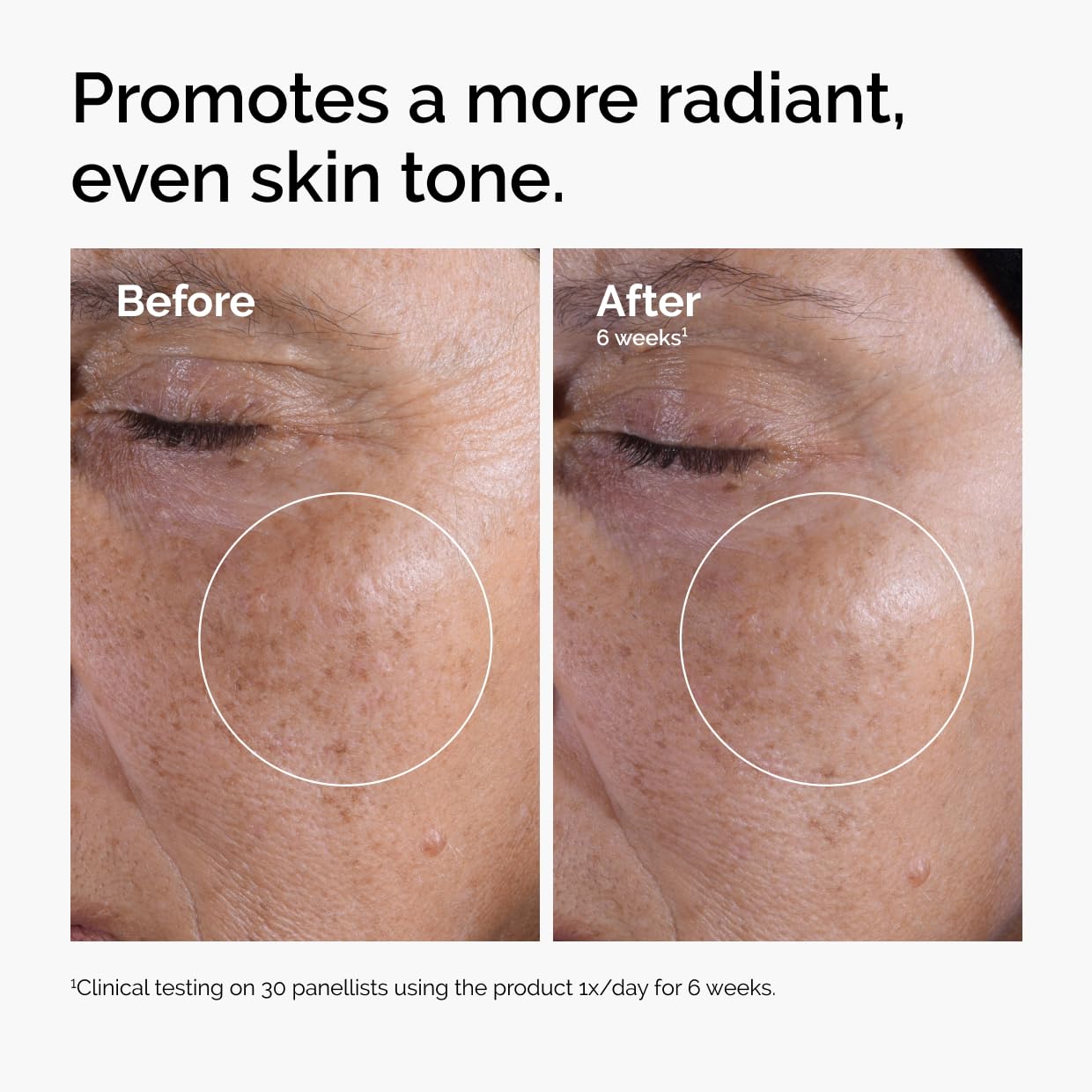 Glycolic Acid 7% Toning Solution – The Ordinary