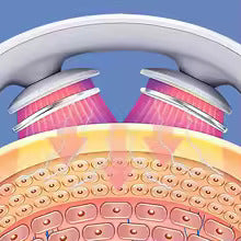 Masajeador Cervical Inteligente
